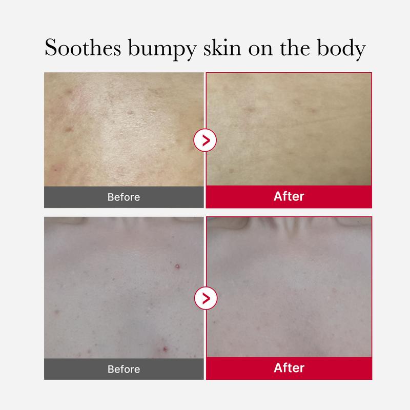 Riovana™ Crimson Body Peel Serum
