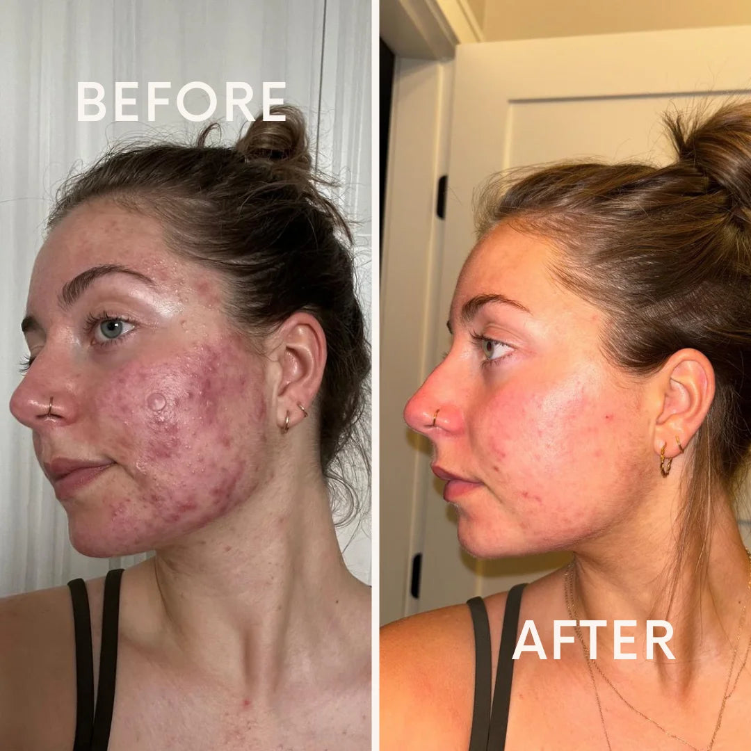Riovana™ HormonaClear+