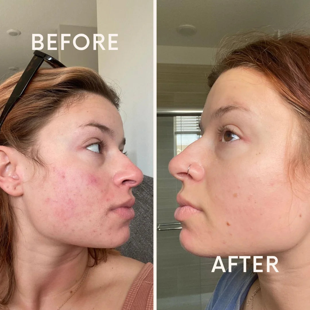 Riovana™ HormonaClear+