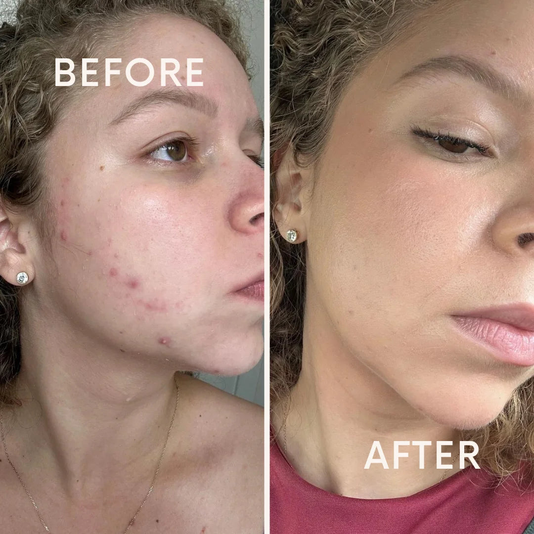 Riovana™ HormonaClear+