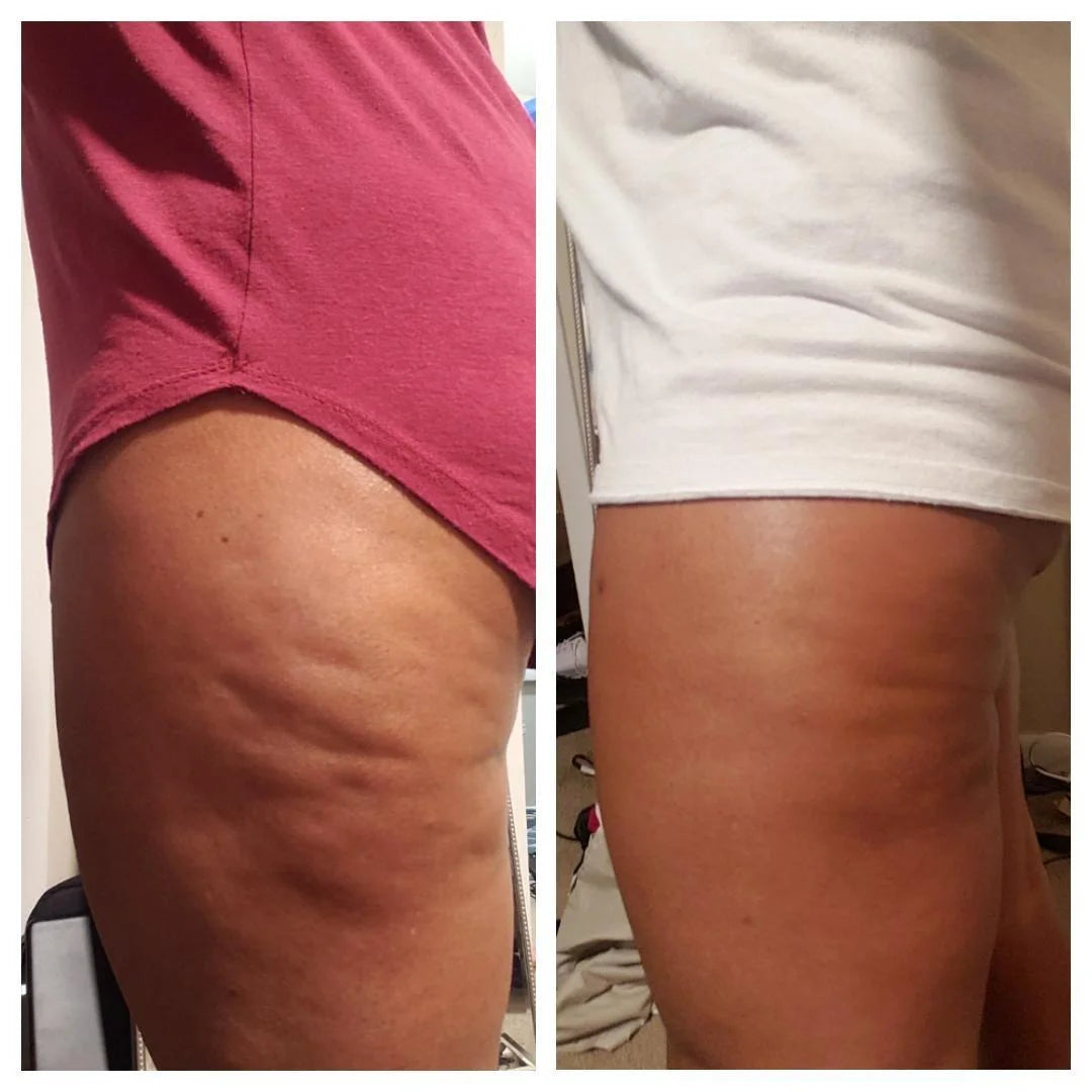 Riovana™ Anti-Cellulite Elixir