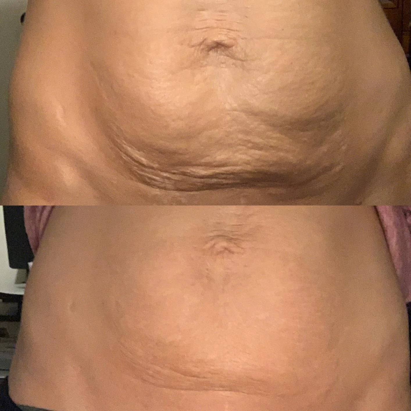 Riovana™ Anti-Cellulite Elixir