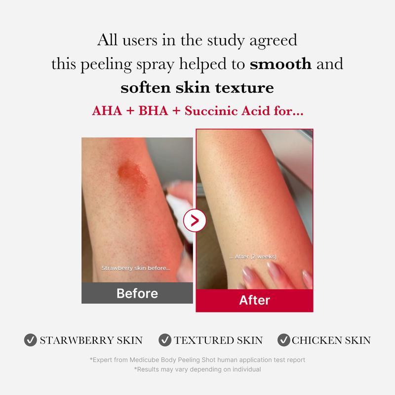 Riovana™ Crimson Body Peel Serum